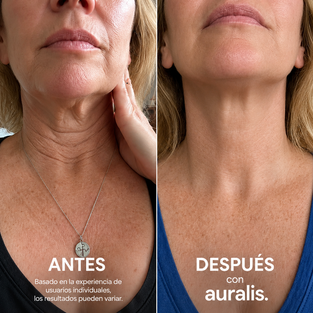 AURALIS®: Crema para estirar y levantar el cuello